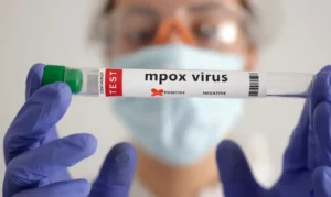 2024-08-20t140130z_1463373049_rc2pj9a34q6t_rtrmadp_3_health-mpox